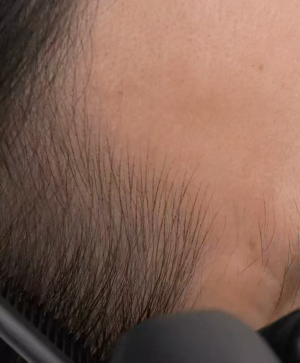 Hairline Tattoo