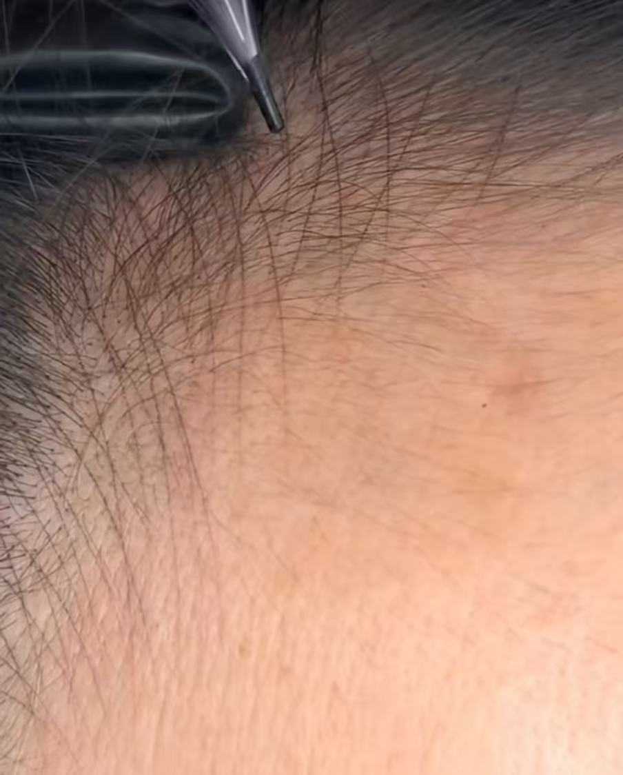 Hairline Tattoo